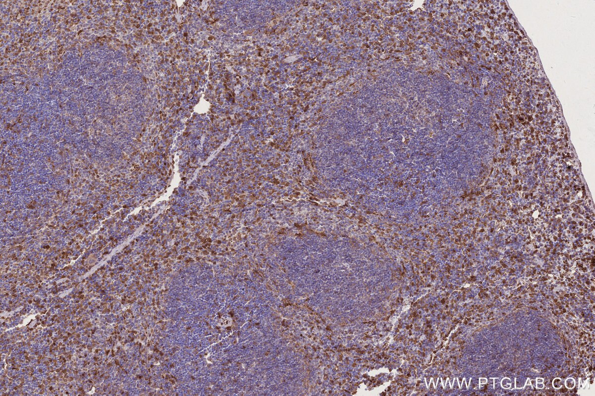 Immunohistochemistry (IHC) staining of mouse spleen tissue using MOSPD2 Recombinant monoclonal antibody (83398-1-RR)