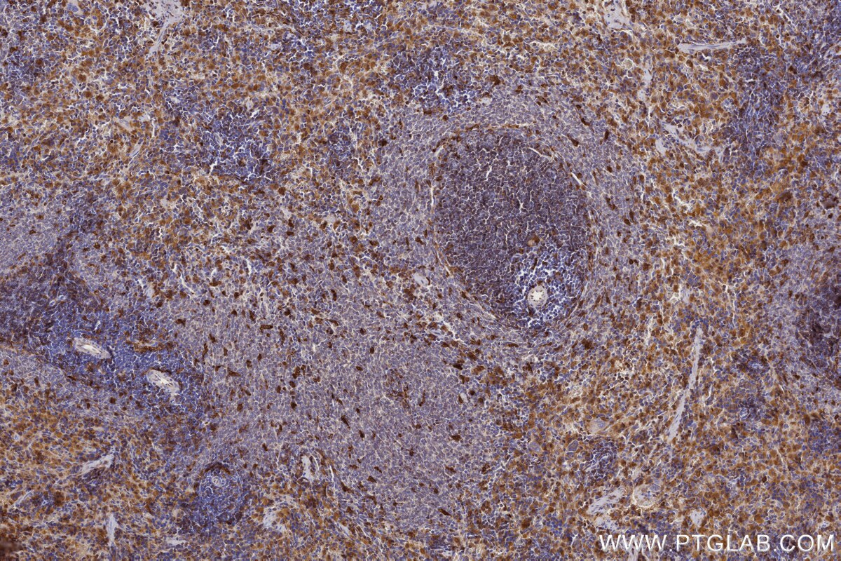 Immunohistochemistry (IHC) staining of rat spleen tissue using MOSPD2 Recombinant monoclonal antibody (83398-1-RR)
