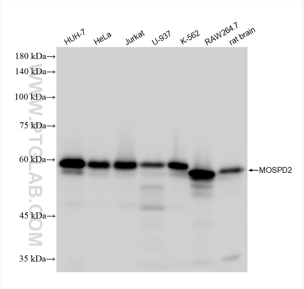 Western Blot (WB) analysis of various lysates using MOSPD2 Recombinant antibody (83398-1-RR)