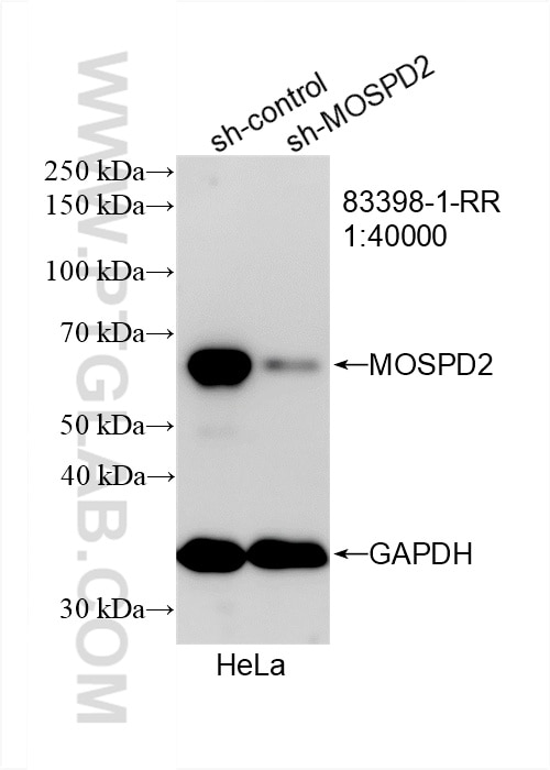 Western Blot (WB) analysis of HeLa cells using MOSPD2 Recombinant antibody (83398-1-RR)
