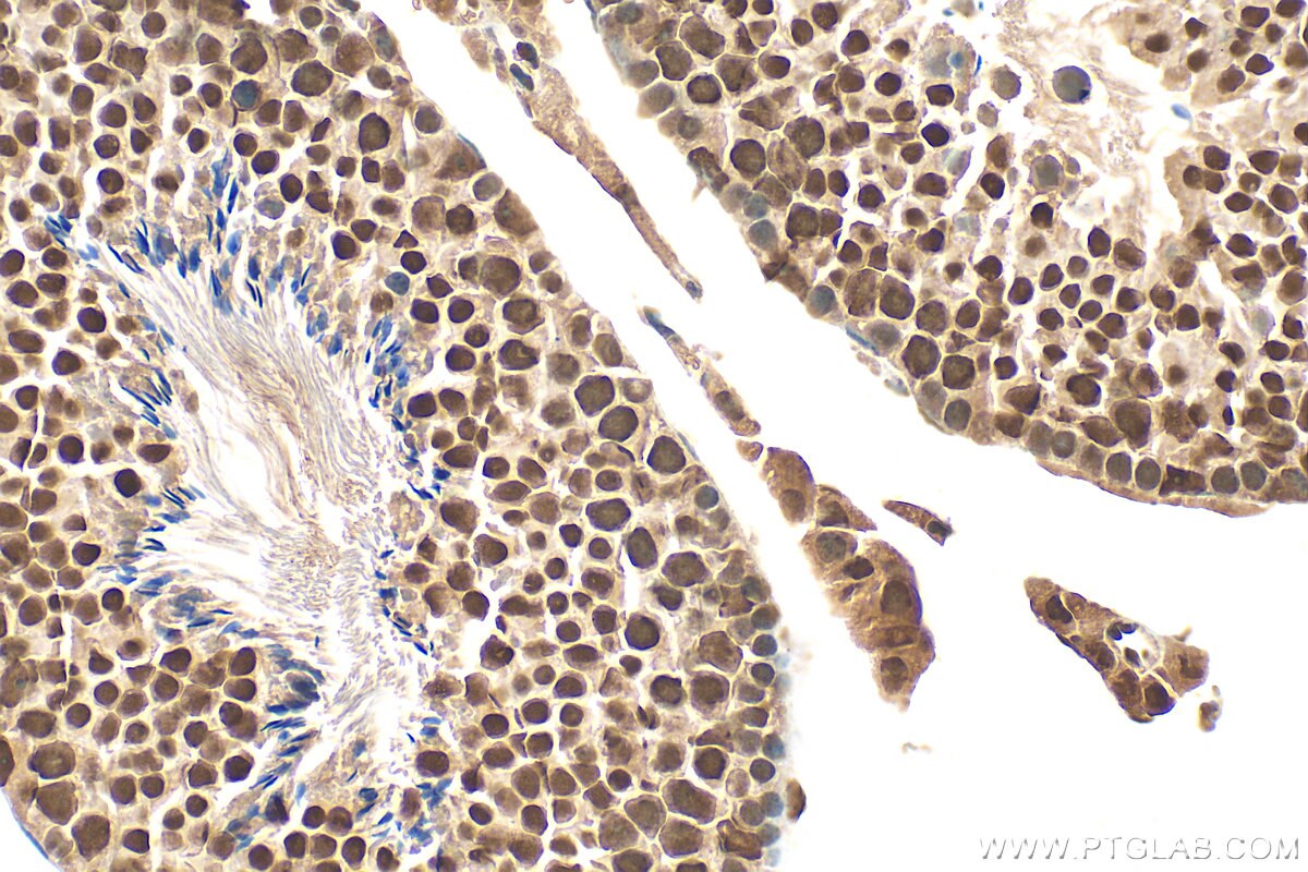 Immunohistochemistry (IHC) staining of mouse testis tissue using MOSPD3 Polyclonal antibody (26168-1-AP)