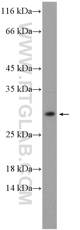 Western Blot (WB) analysis of mouse testis tissue using MOSPD3 Polyclonal antibody (26168-1-AP)