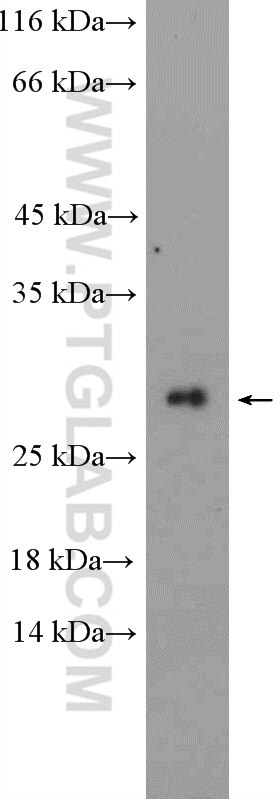Western Blot (WB) analysis of Jurkat cells using MOSPD3 Polyclonal antibody (26168-1-AP)