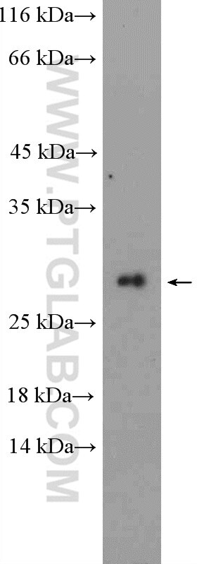 WB analysis of Jurkat using 26168-1-AP