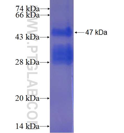 MOSPD3 fusion protein Ag23101 SDS-PAGE