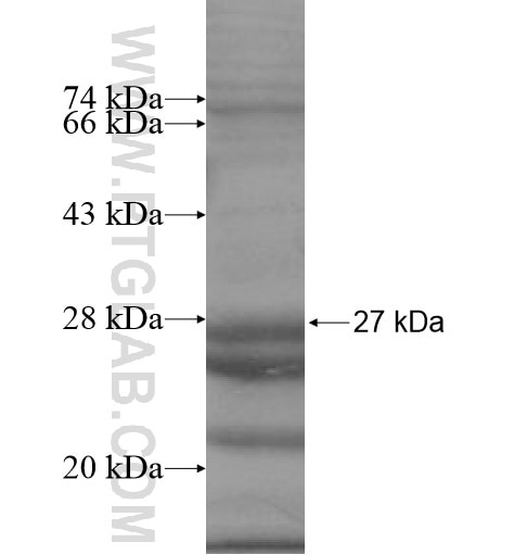 MOSPD3 fusion protein Ag15421 SDS-PAGE
