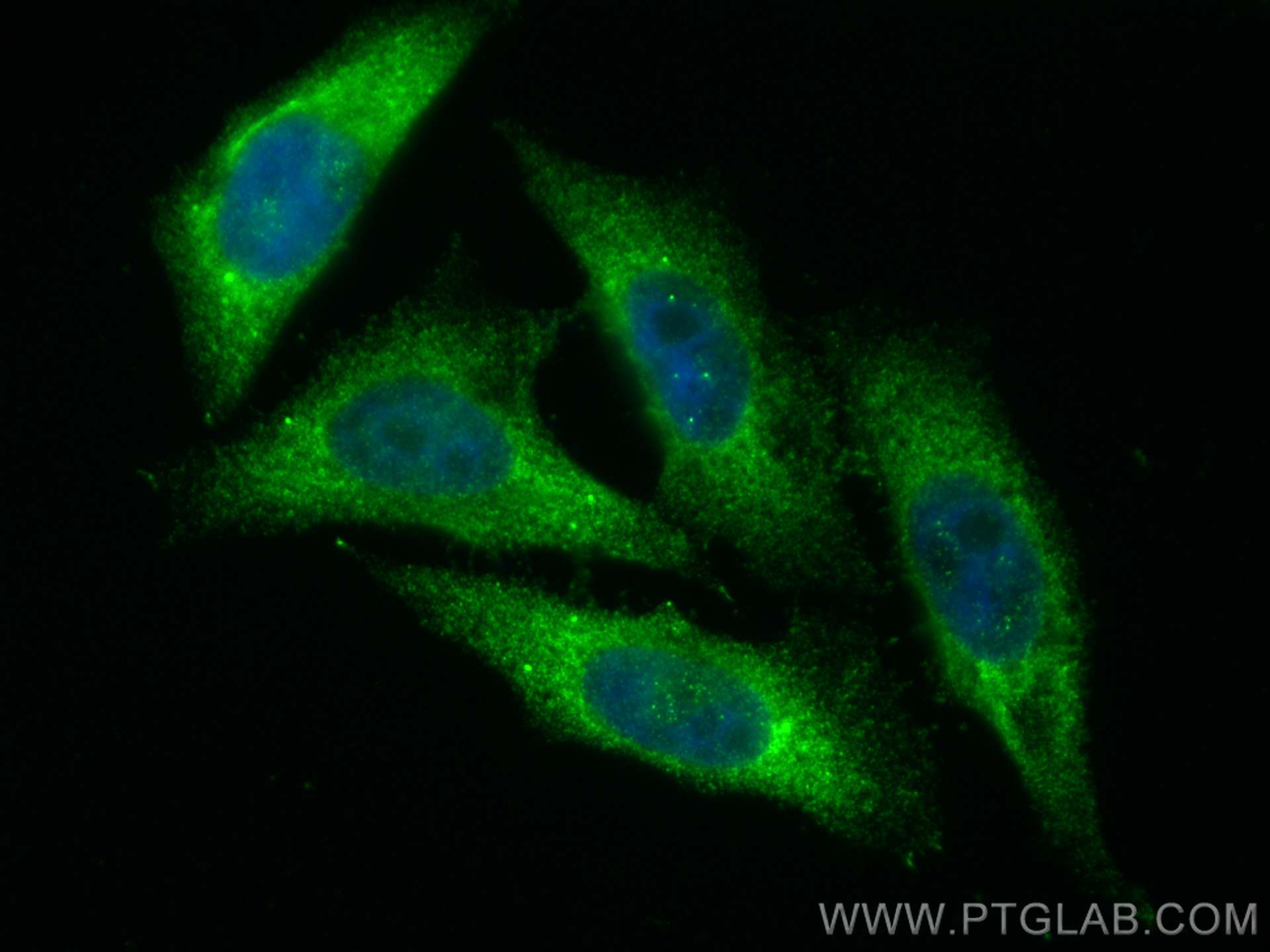 Immunofluorescence (IF) / fluorescent staining of HepG2 cells using MOV10 Polyclonal antibody (10370-1-AP)
