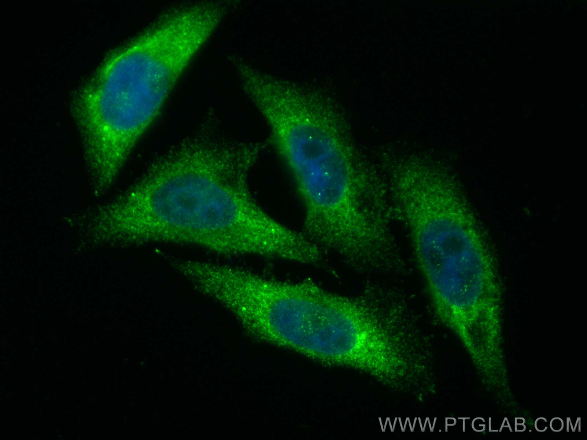 IF Staining of HepG2 using 10370-1-AP