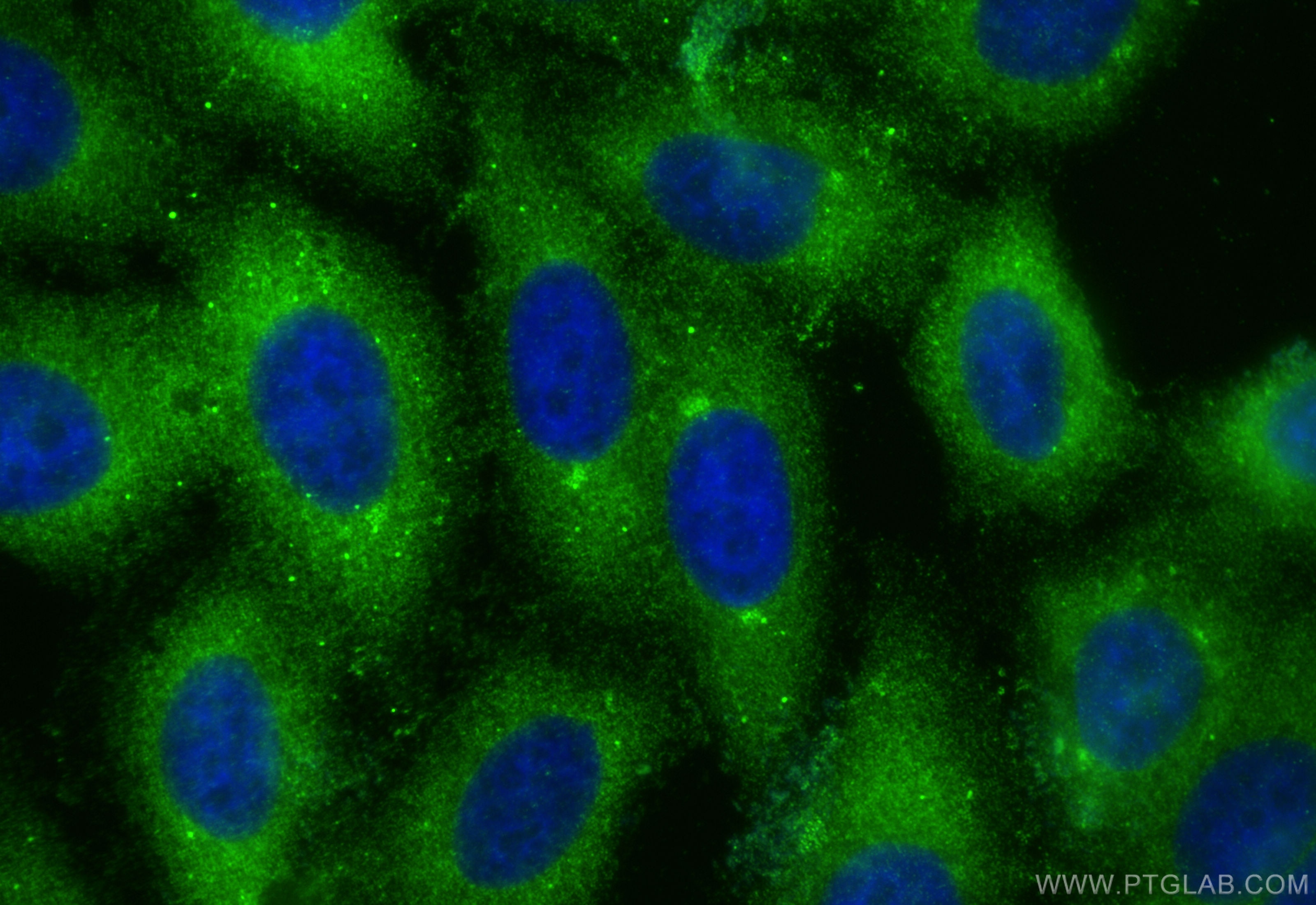 Immunofluorescence (IF) / fluorescent staining of HepG2 cells using MOV10 Polyclonal antibody (10370-1-AP)