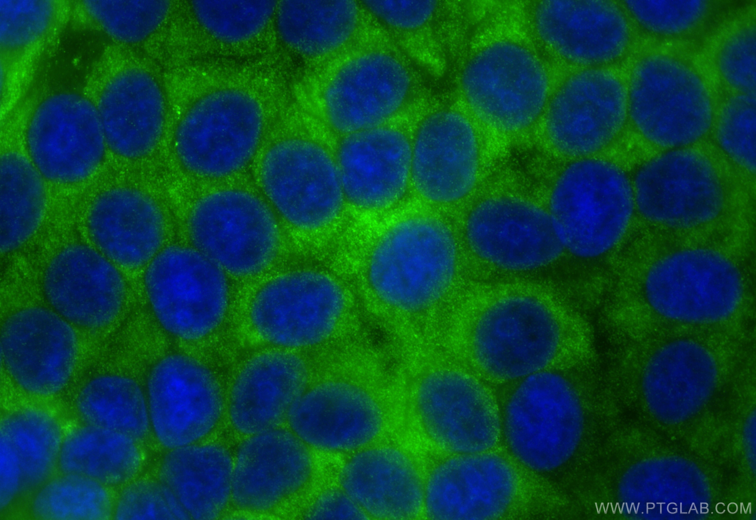 Immunofluorescence (IF) / fluorescent staining of MCF-7 cells using MOV10 Polyclonal antibody (10370-1-AP)