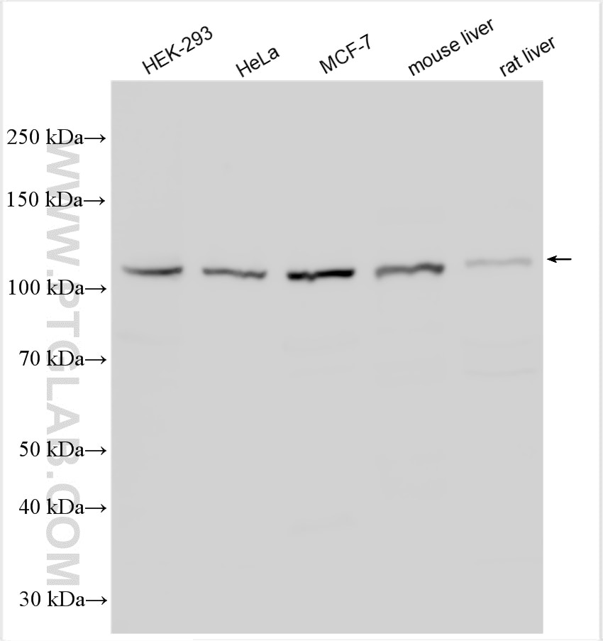 Western Blot (WB) analysis of various lysates using MOV10 Polyclonal antibody (10370-1-AP)
