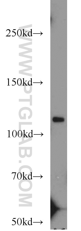 Western Blot (WB) analysis of HepG2 cells using MOV10 Polyclonal antibody (10370-1-AP)