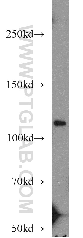 WB analysis of HepG2 using 10370-1-AP