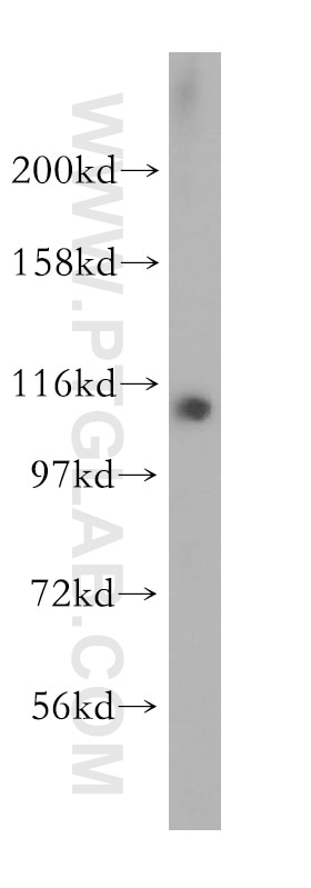 Western Blot (WB) analysis of human liver tissue using MOV10 Polyclonal antibody (10370-1-AP)