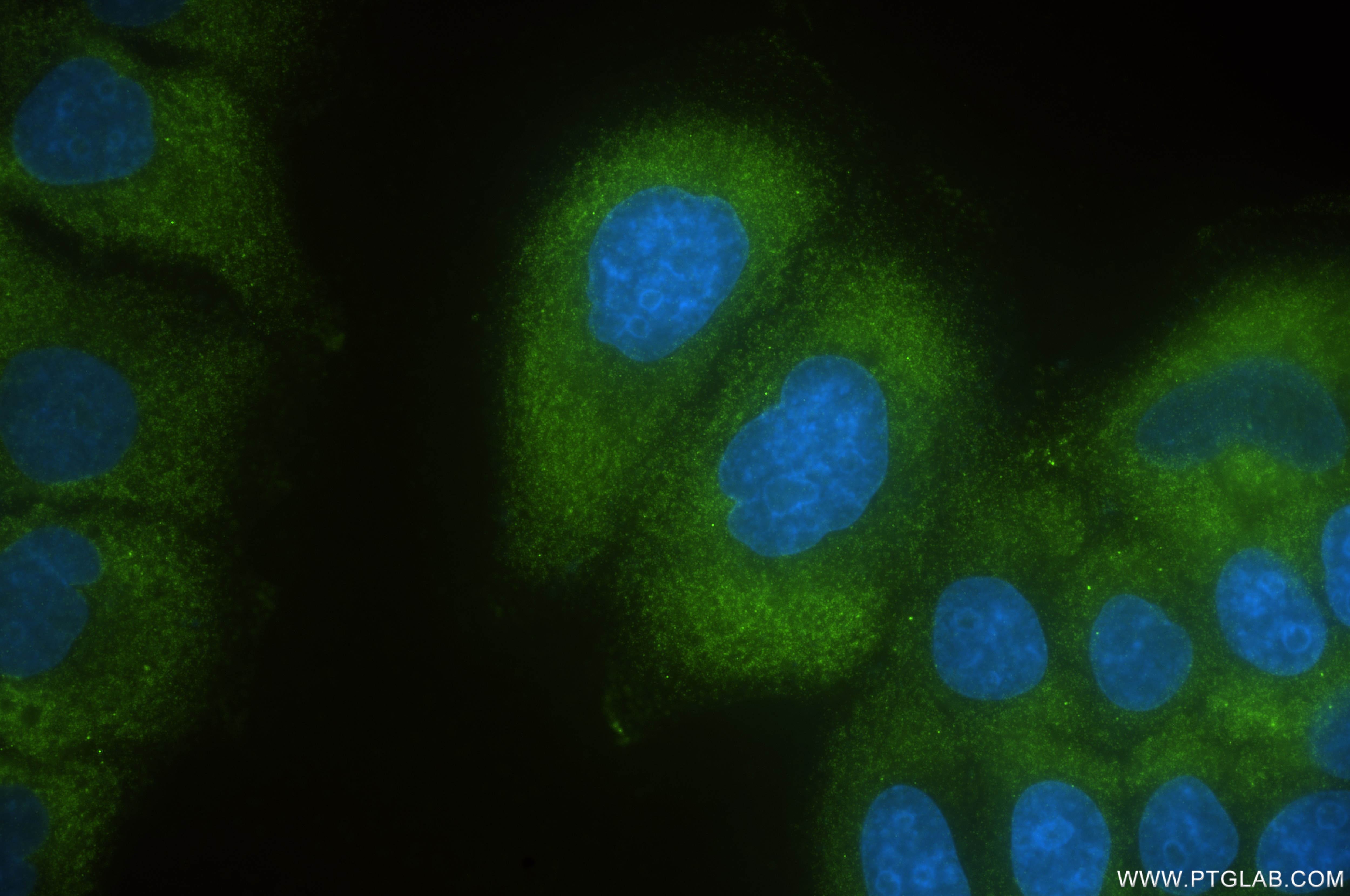 Immunofluorescence (IF) / fluorescent staining of HepG2 cells using MOV10 Recombinant antibody (85818-5-RR)