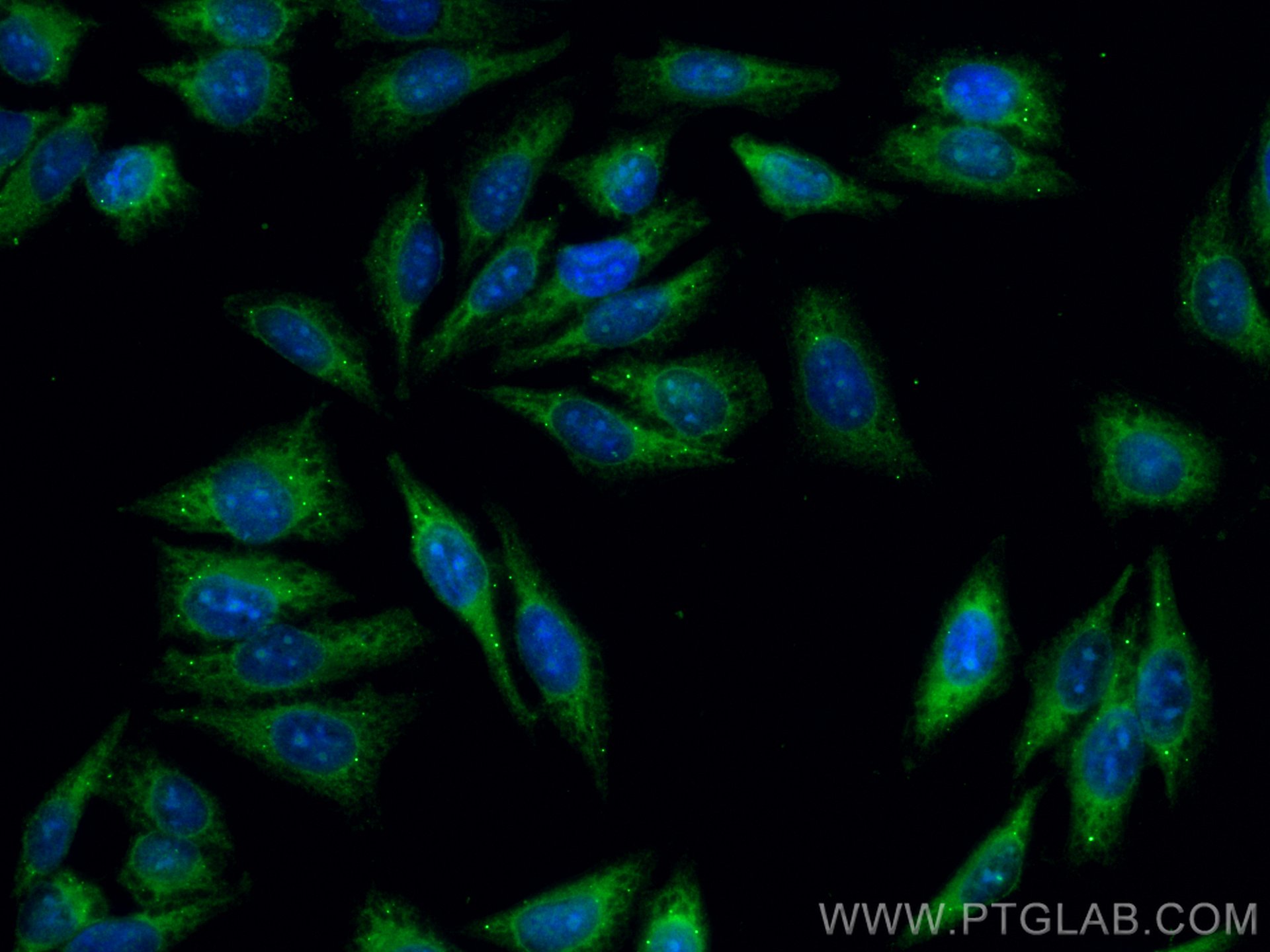 Immunofluorescence (IF) / fluorescent staining of HepG2 cells using CoraLite® Plus 488-conjugated MOV10 Polyclonal ant (CL488-10370)