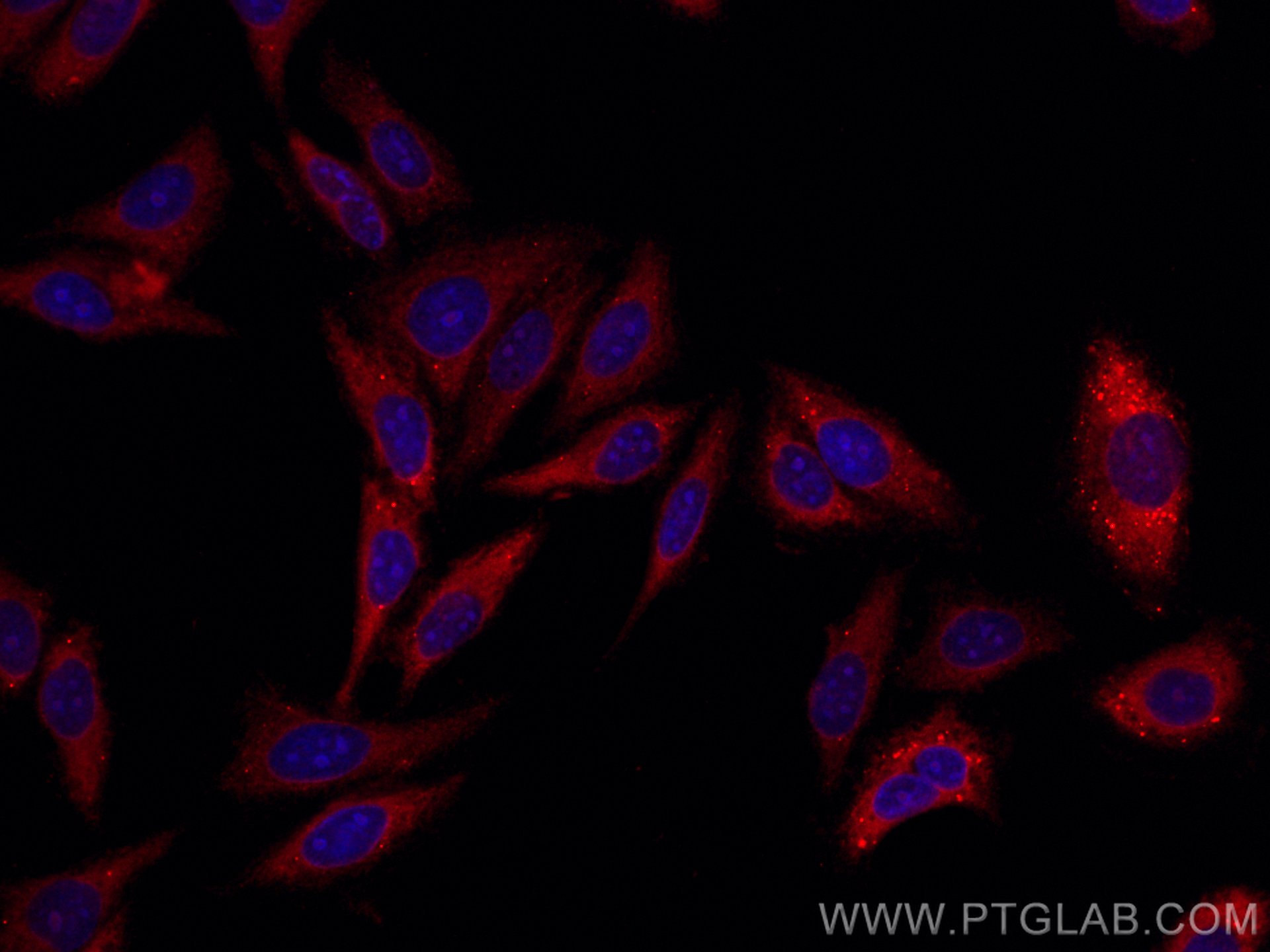 IF Staining of HepG2 using CL594-10370