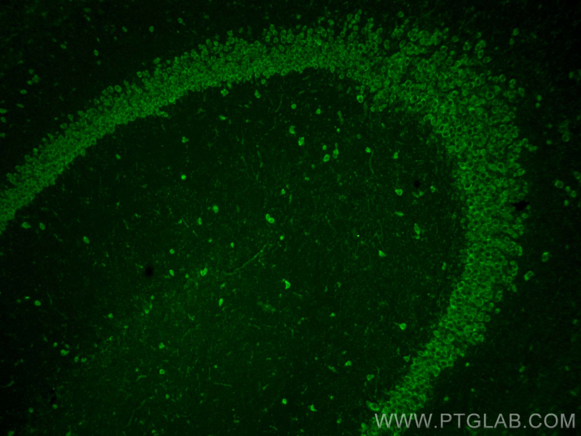 Immunofluorescence (IF) / fluorescent staining of mouse brain tissue using MOXD1 Polyclonal antibody (11545-1-AP)