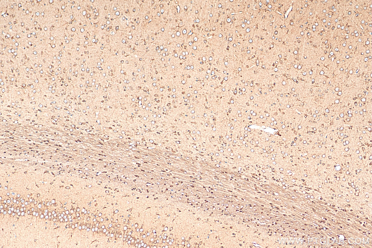 Immunohistochemistry (IHC) staining of rat brain tissue using MOXD1 Polyclonal antibody (11545-1-AP)