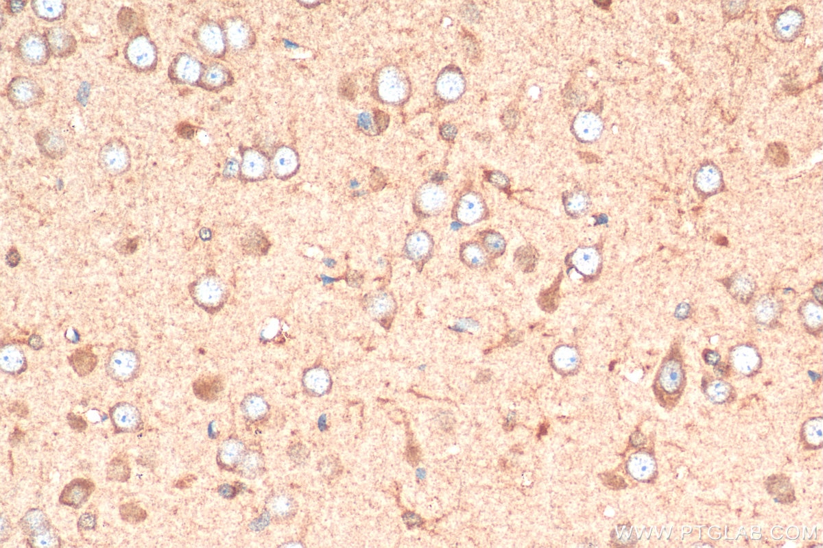 Immunohistochemistry (IHC) staining of rat brain tissue using MOXD1 Polyclonal antibody (11545-1-AP)