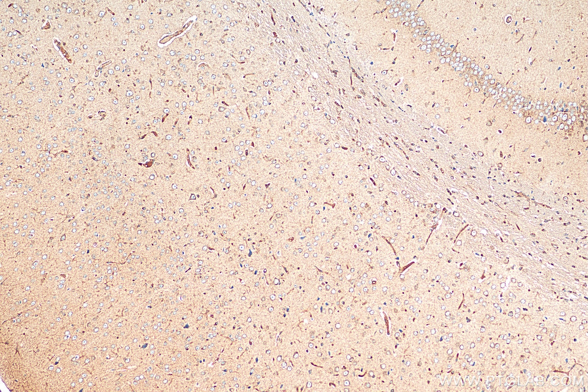 Immunohistochemistry (IHC) staining of mouse brain tissue using MOXD1 Polyclonal antibody (11545-1-AP)