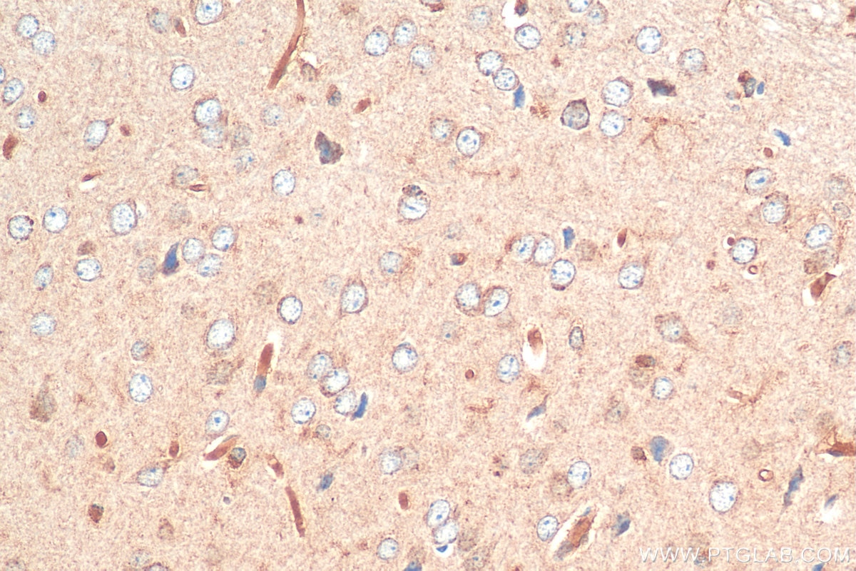 Immunohistochemistry (IHC) staining of mouse brain tissue using MOXD1 Polyclonal antibody (11545-1-AP)