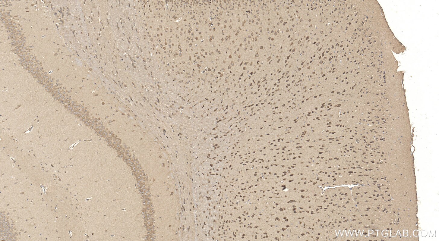 Immunohistochemistry (IHC) staining of mouse brain tissue using MOXD1 Polyclonal antibody (11545-1-AP)