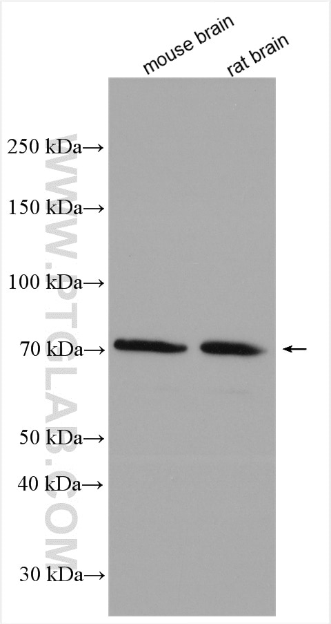 Western Blot (WB) analysis of various lysates using MOXD1 Polyclonal antibody (11545-1-AP)