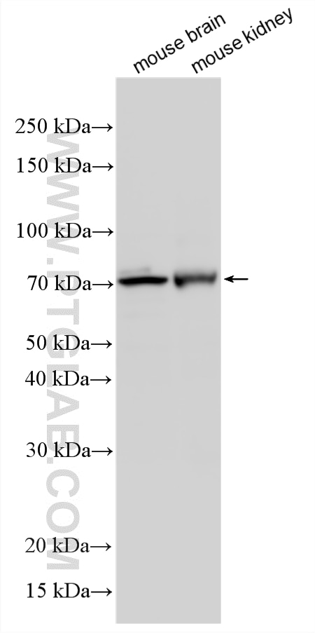 Western Blot (WB) analysis of various lysates using MOXD1 Polyclonal antibody (29913-1-AP)