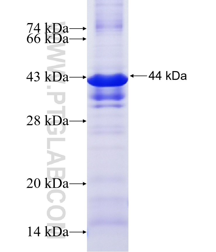 MOXD1 fusion protein Ag19203 SDS-PAGE