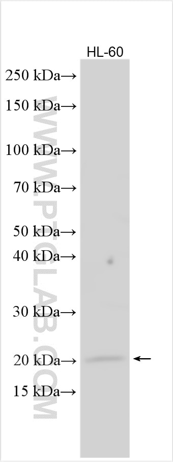 Western Blot (WB) analysis of various lysates using MPC1 Polyclonal antibody (30868-1-AP)