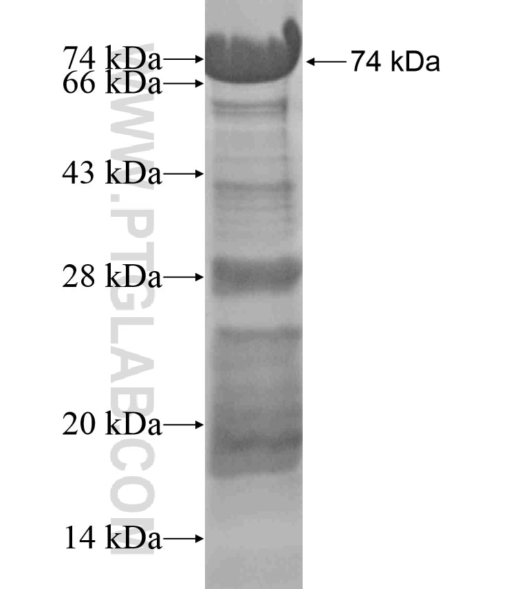 MUPP1 fusion protein Ag18222 SDS-PAGE