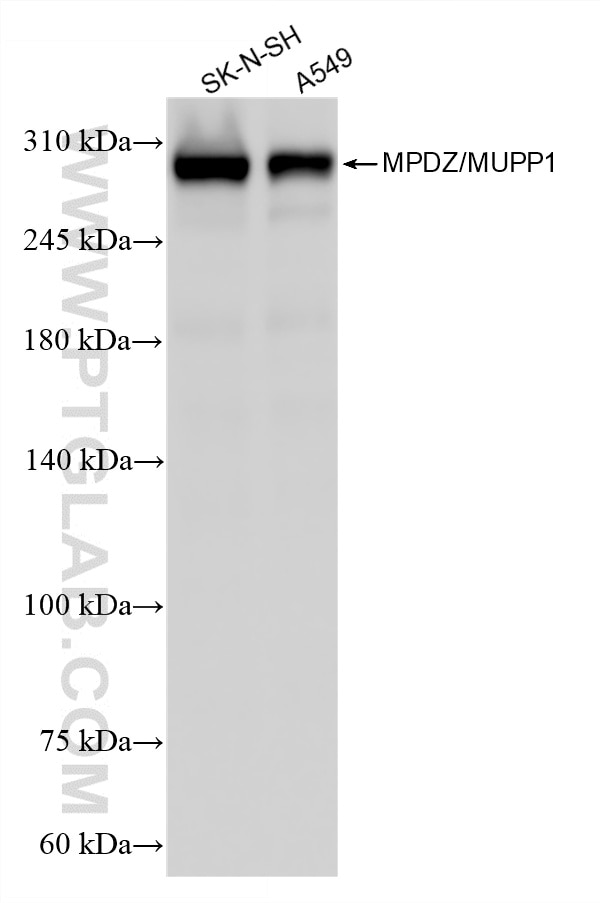 Western Blot (WB) analysis of various lysates using MPDZ/MUPP1 Recombinant monoclonal antibody (87358-1-RR)
