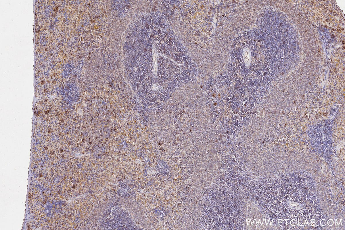 Immunohistochemistry (IHC) staining of rat spleen tissue using MPEG1 Polyclonal antibody (23960-1-AP)