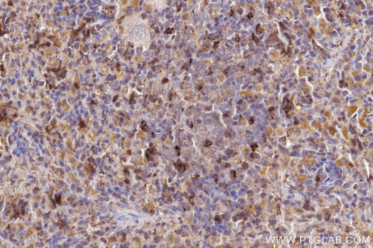 Immunohistochemistry (IHC) staining of rat spleen tissue using MPEG1 Polyclonal antibody (23960-1-AP)