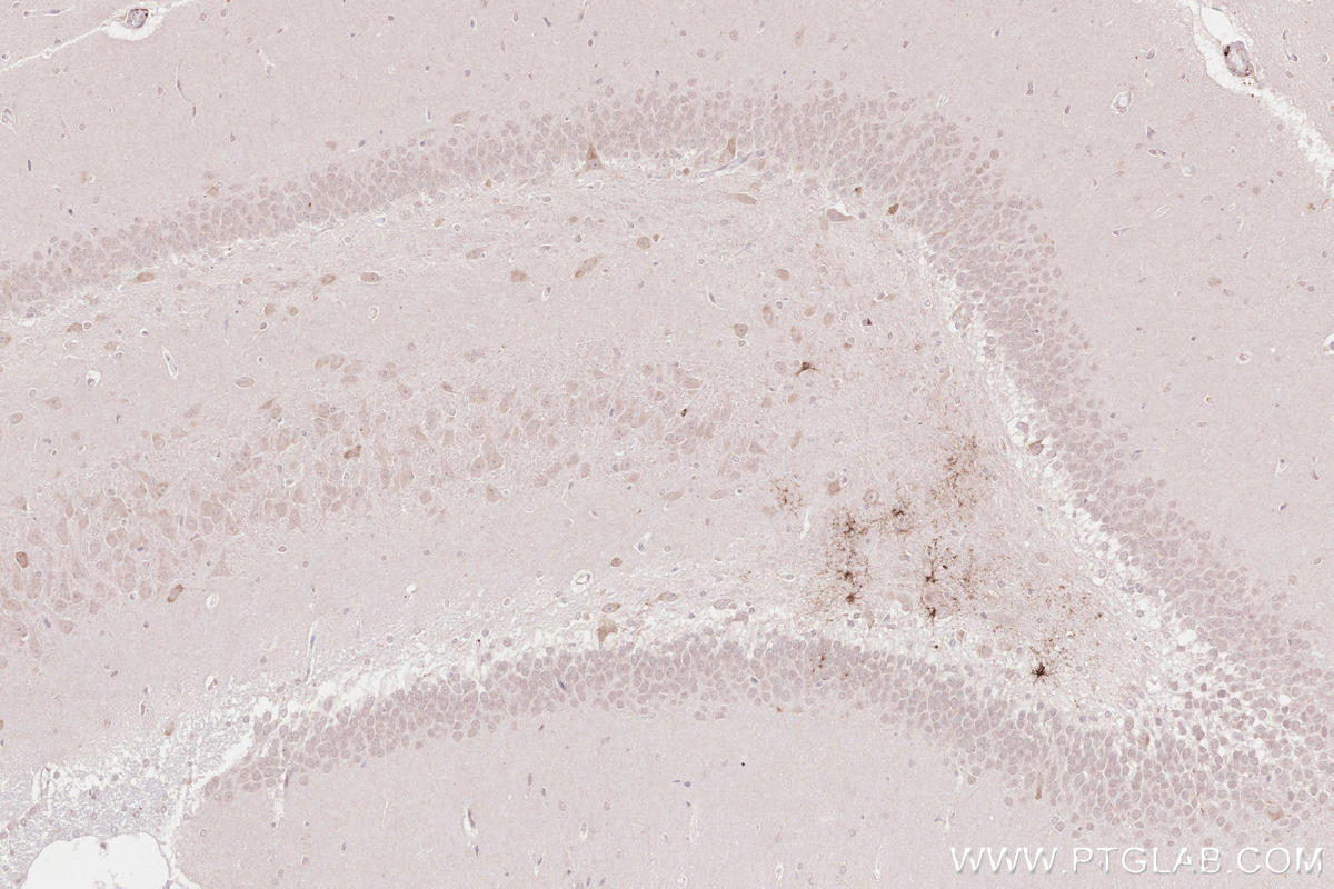 Immunohistochemistry (IHC) staining of rat brain tissue using MPEG1 Polyclonal antibody (23960-1-AP)