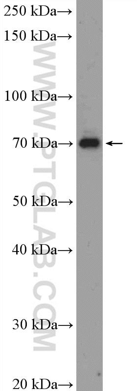 Western Blot (WB) analysis of HeLa cells using MPEG1 Polyclonal antibody (23960-1-AP)