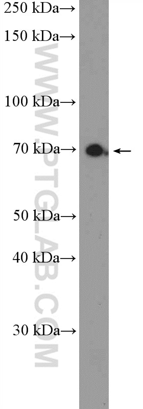 Western Blot (WB) analysis of HeLa cells using MPEG1 Polyclonal antibody (23960-1-AP)