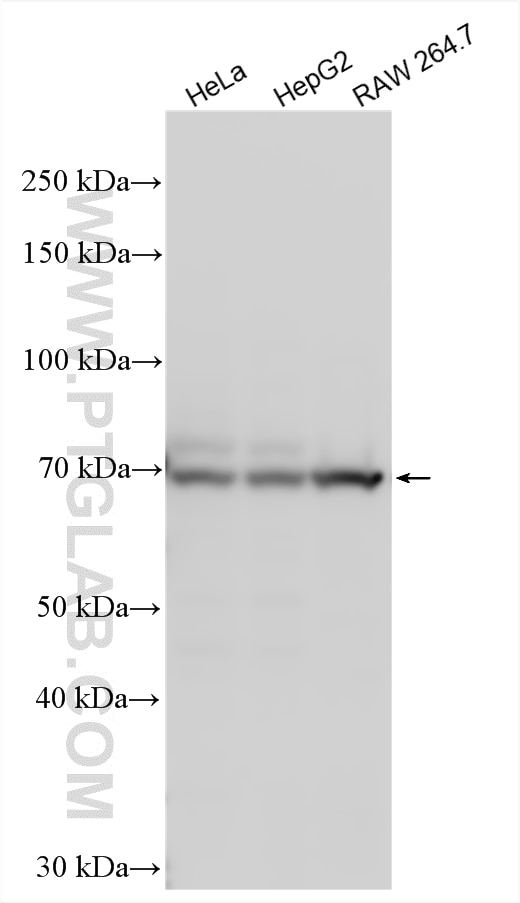 Western Blot (WB) analysis of various lysates using MPEG1 Polyclonal antibody (23960-1-AP)