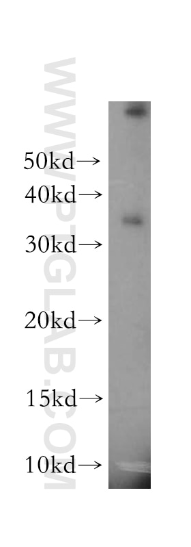 Western Blot (WB) analysis of MCF-7 cells using MPG Polyclonal antibody (11481-2-AP)