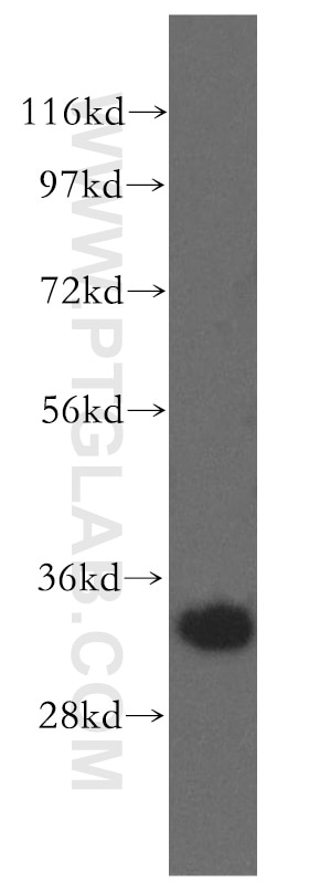 WB analysis of MCF-7 using 11481-2-AP