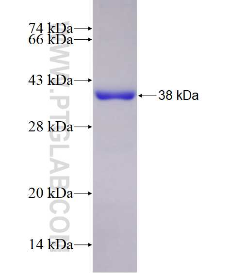 MPG fusion protein Ag28647 SDS-PAGE