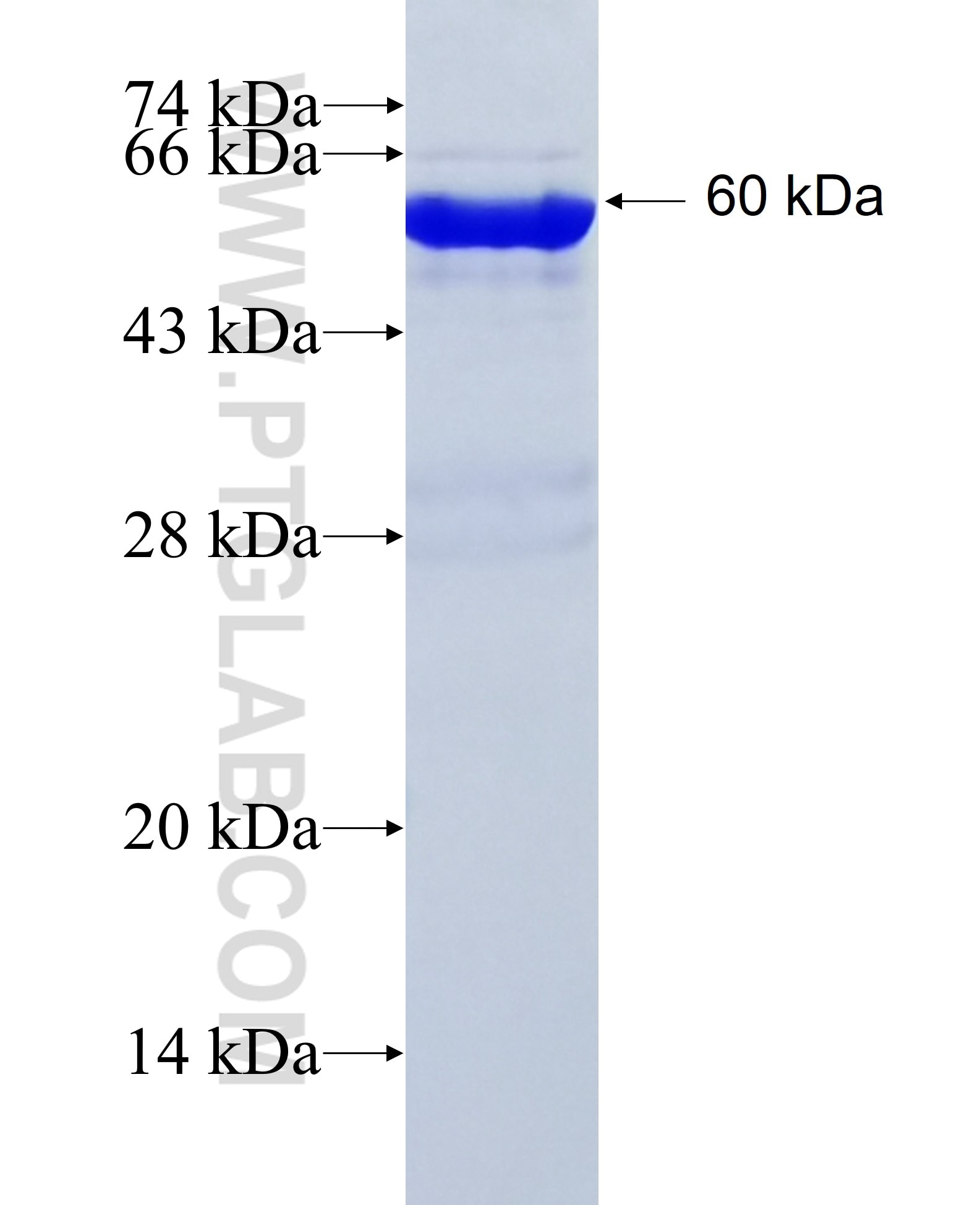MPHOSPH10 fusion protein Ag37602 SDS-PAGE