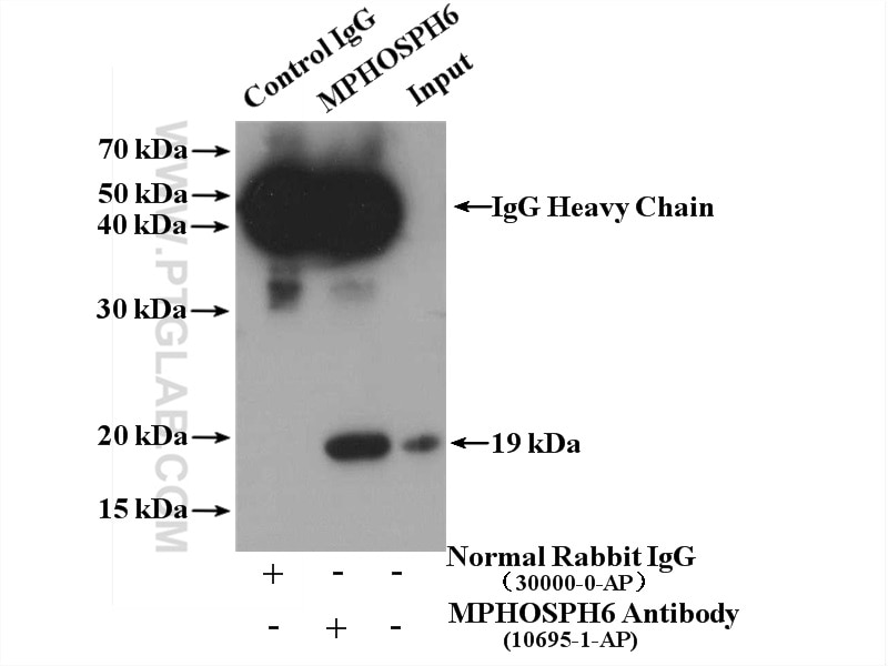 Immunoprecipitation (IP) experiment of HeLa cells using MPHOSPH6 Polyclonal antibody (10695-1-AP)