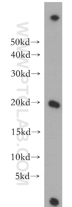 Western Blot (WB) analysis of HeLa cells using MPHOSPH6 Polyclonal antibody (10695-1-AP)