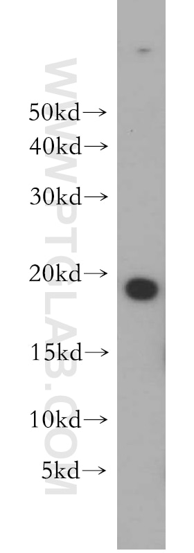 Western Blot (WB) analysis of HeLa cells using MPHOSPH6 Polyclonal antibody (10695-1-AP)