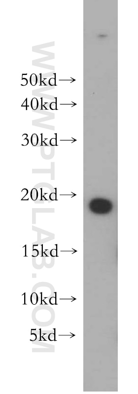 WB analysis of HeLa using 10695-1-AP