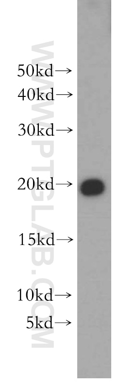 WB analysis of MCF-7 using 10695-1-AP