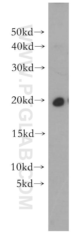 Western Blot (WB) analysis of MDA-MB-453s cells using MPHOSPH6 Polyclonal antibody (10695-1-AP)