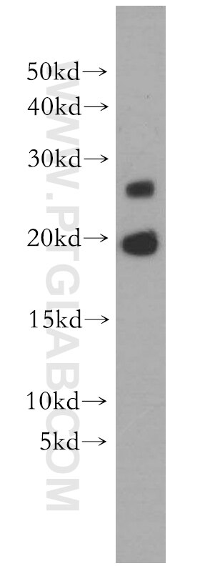 MPHOSPH6